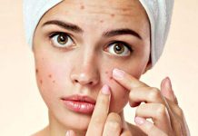 Sivilce Maskesi en etkili sivilce maskesi yapımı