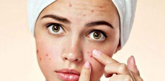 Sivilce Maskesi en etkili sivilce maskesi yapımı