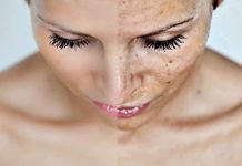 Siyah Noktalar İçin Maske Siyah Noktalar İçin Maske