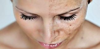 Siyah Noktalar İçin Maske Siyah Noktalar İçin Maske