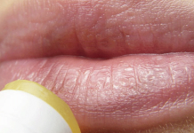 En İyi Uçuk Kremi en iyi uçuk kremi