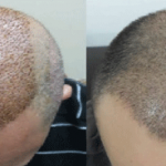 naturel-hair-sac-ekim-merkezi-ankara