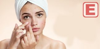 En İyi Sivilce Kremi Eczane En İyi Sivilce Kremi Eczane