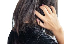 En İyi Kepek Şampuanı En İyi Kepek Şampuanı